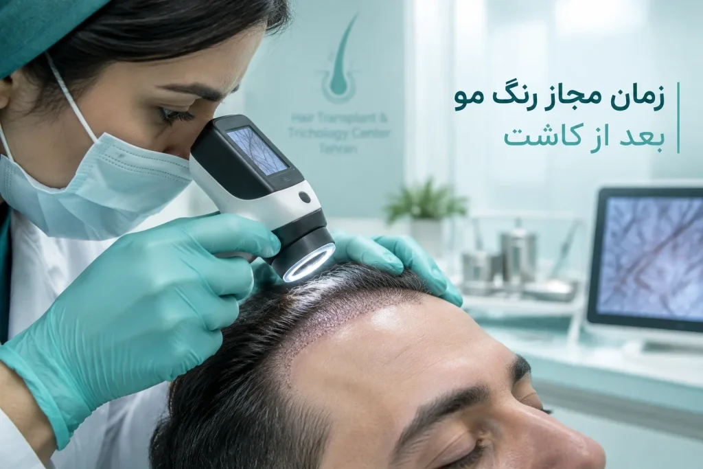 بعد از چند وقت از کاشت میشه موهارو رنگ مرد