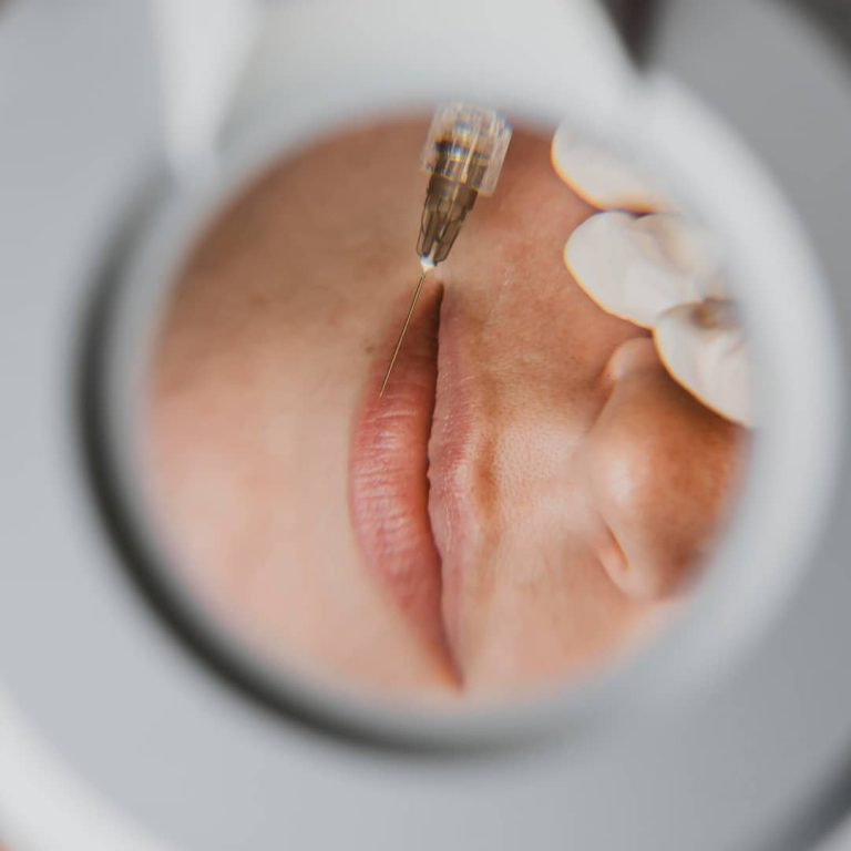 فیلر لب ها با توجه به استفاده از مواد شیمیایی ممکن است باعث حساسیت ها یا در برخی موارد مشکلات پزشکی حاد شود.