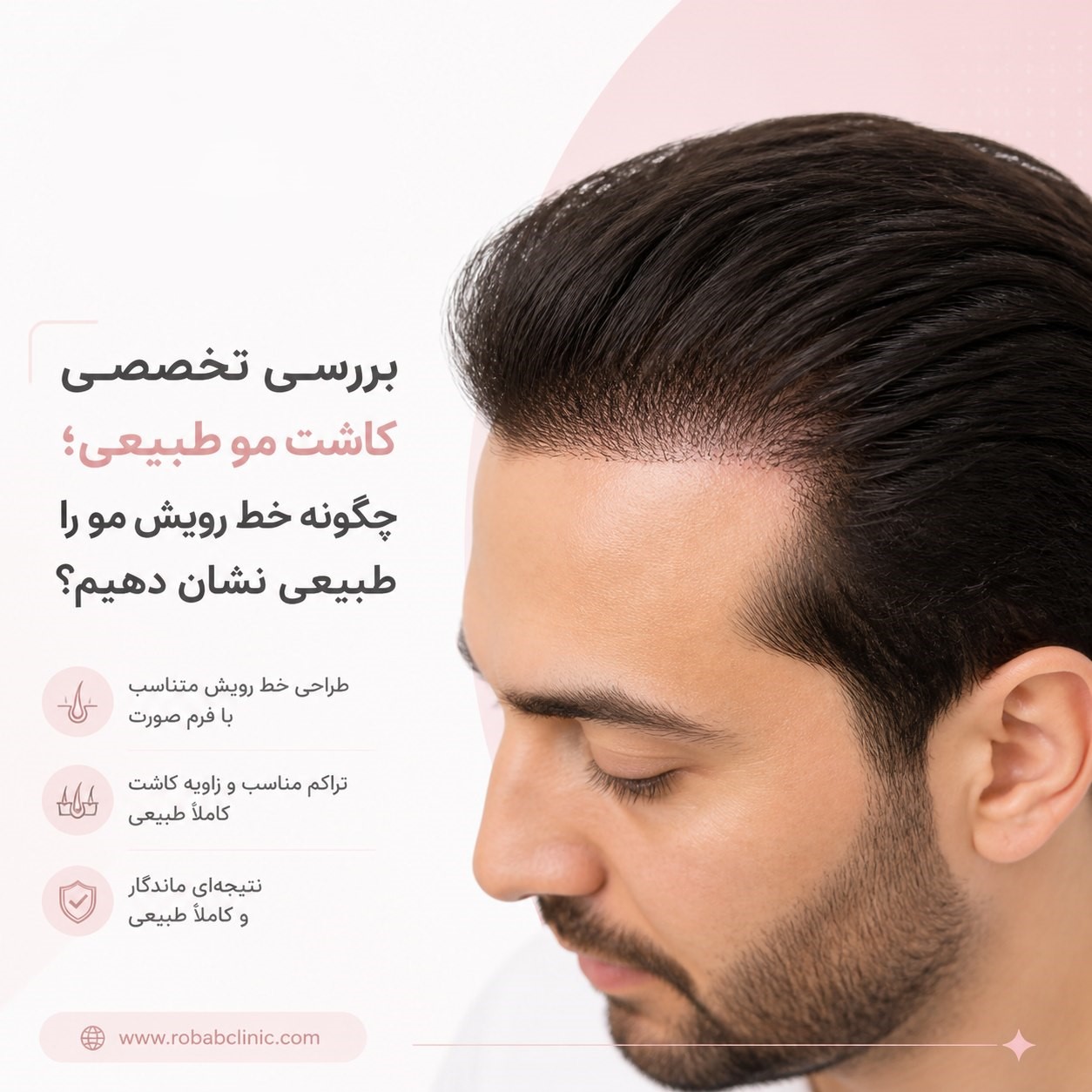 کاشت مو طبیعی (1)
